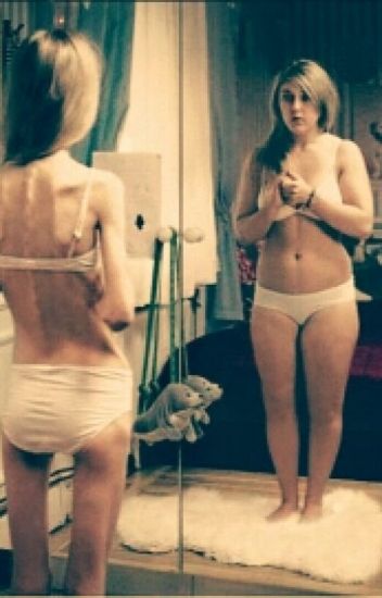 Historia De Una Anorexica